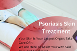 How does the effectiveness of biologic treatments for psoriasis compare to traditional systemic…