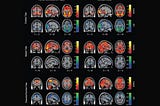 Stories, Stereotypes & Brain Scans: The Better Story of the Science of Story