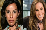 Melissa Rivers Plastic Surgery Before and After 2016