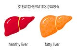 Fatty Liver Causes, Signs, and Prevention