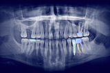 Backing Allisone: a global dentistry operating system
