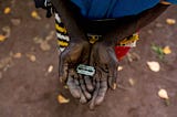 Female genital mutilation (FGM)
