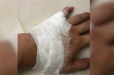 How To Deal With A Wound In A Crisis Without Going to the ER