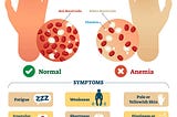 ANEMIA