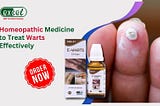 Best Homeopathic Treatment for Warts at Excel Pharma