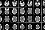 Will imaging-based biomarkers of psychiatric conditions ever be clinically useful?