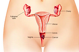 5 Warning Signs Of Vaginal Cancer