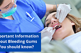 Important Information about Bleeding Gums You should know