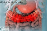 آیا سندروم روده تحریک پذیر باعث سرطان میشود