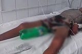 Sprite bottle instead of urine collection bag attached to patient in Bihar hospital