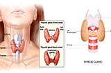 Thyroidectomy Surgery: A Comprehensive Overview