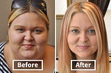 How Weight loss Changes Your face?