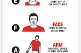 HOW TO SPOT A CVA(STROKE) FAST