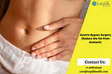 ic Gastric Bypass Surgery in Thailand