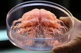 “Animal Engraftment: Human Brain Organoids Show Remarkable Growth.”