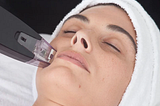 Guide To Microneedling
