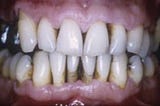 “Periodontitis – a risk factor for COVID-19 “