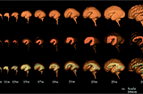 I/O for Your Cerebral Cortex