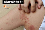 Homeopathy Treatment for Impetigo | Impetigo treatment for babies
