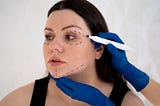 Everything You Need to Know Before Getting a Mini Facelift
