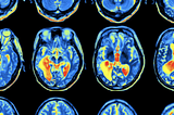 Classifying ADHD from healthy controls using LSTMs with rs-fMRI data