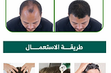 أفضل علاج لتساقط الشعر للرجال والنساء في السعودية