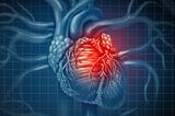 iCHD — Predicting Heart Disease