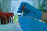 Exam-gloved hands hold a lab vial. In the background is a tray of blood-filled vials.