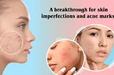 A breakthrough for skin imperfections and acne marks