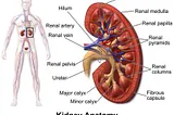 Kidney stones