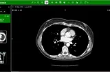 How Are Advanced DICOM Viewers Transforming Medical Imaging for Radiologists?