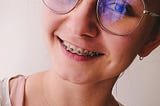 My First Day With Braces