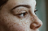Closeup of woman’s face with freckles.