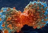 Insulin Sensitivity Decreases Cancer Risk