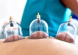 What Are The Necessary Preparations Before Hijama Cupping Therapy?