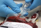 HIV Cure Via Cord-Blood Stem Cell Transplant