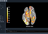 Understanding Brain-Computer Interfaces with Python