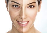 Get state-of-the-art Botox and Fillers Treatment Philadelphia!!!