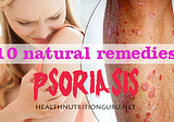 Treating Psoriasis with home natural remedies. Foods and habits to avoid.