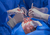 Nova técnica de implante de órgãos promete eliminar o risco de rejeição