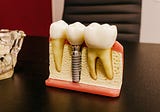 What is Dental Implant Surgery?