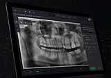 The Future of AI in Dentistry & How AI Works in Dental Radiology