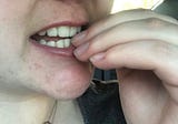 Covid-19 Stopped Me From Digging My Nose And Biting My Nails
