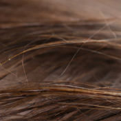 Hair Loss, Explained