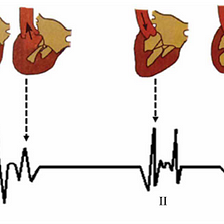 A Review of Computer-Aided Heart Sound Detection Techniques