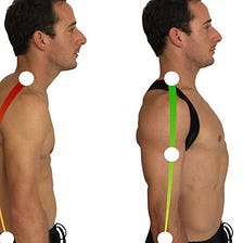 قوز کمر یا قوز پشتی چیست ؟