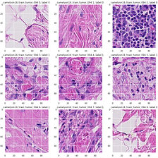 Histopathologic cancer detection as image classification using Pytorch