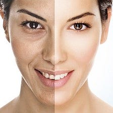 Get state-of-the-art Botox and Fillers Treatment Philadelphia!!!