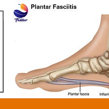 درد کف پا نشانه چیست و بهترین راهکارهای خلاصی از آن