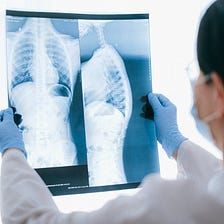 Machine Learning in healthcare may not need as many labeled data as before